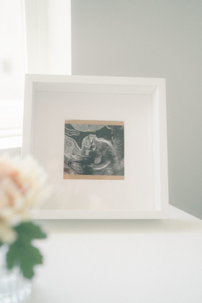 ultrasound photo of newborn in the nursery in Salt Lake City Utah by Utah newborn and baby photographer